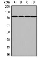 IHC-plus™ Polyclonal Rabbit anti-Human Heparanase 2 / HPSE2 Antibody (IHC, WB)