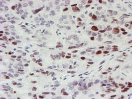 MLF1 Antibody (clone OTI5D9)