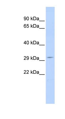 SHISA5 / SCOTIN Antibody (aa72-121)