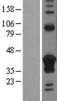 CD74 / CLIP Protein (Over-Expression Lysate Myc-DDK (Flag))