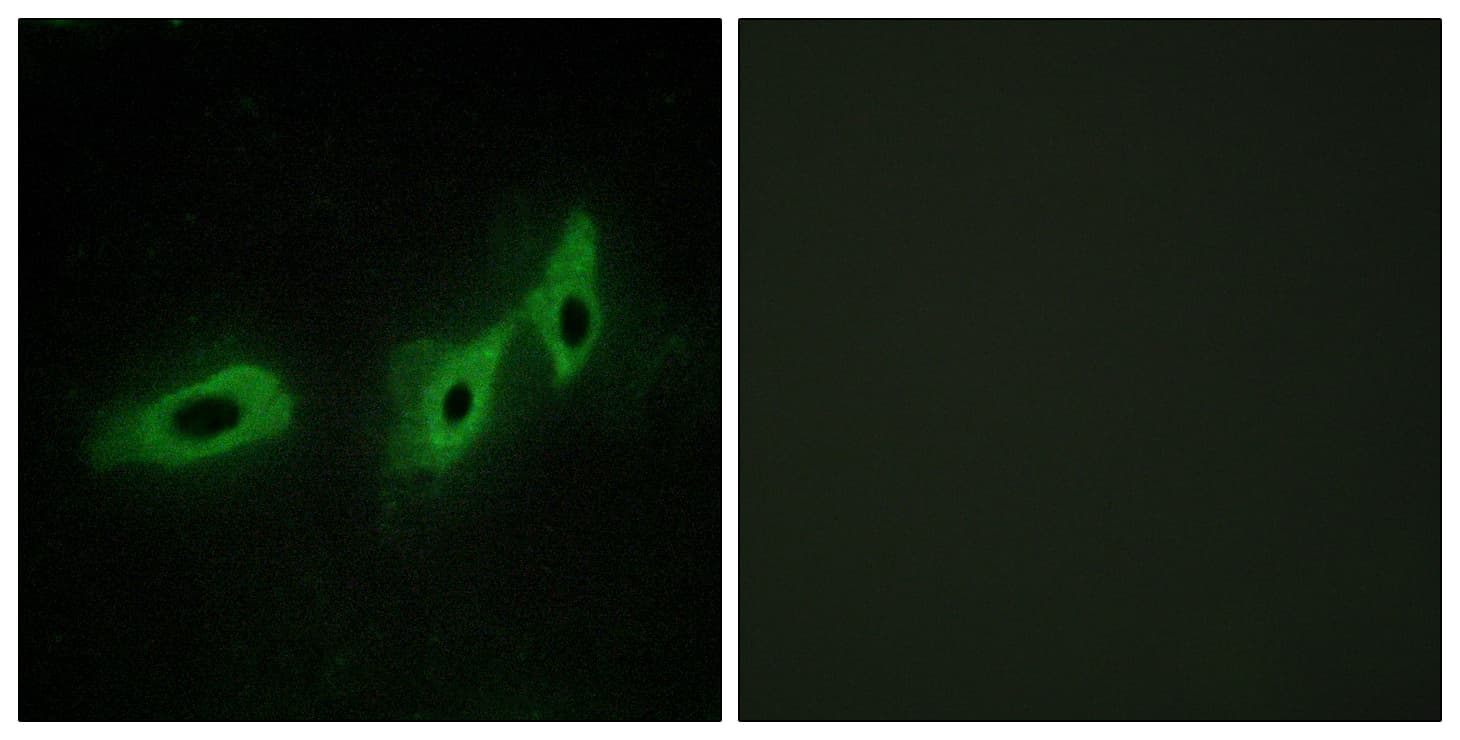 MID1 Antibody (aa71-120)