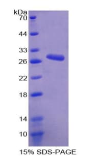Mouse ANO1 / DOG1 / TMEM16A Protein (Recombinant His-T7)