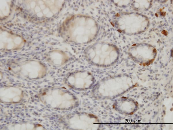 TRIB2 Antibody (clone 1B1)