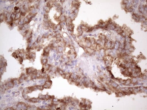 Monoclonal Mouse anti-Human BMF Antibody (clone OTI3H5, IHC, WB)