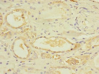 E4 / UBE4A Antibody
