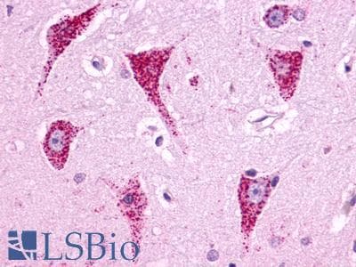 PathPlus™ Polyclonal Rabbit anti-Human B1R / BDKRB1 Antibody (Cytoplasmic Domain, IHC)