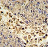Polyclonal Rabbit anti-Human COLEC11 Antibody (aa50-78, IHC, WB)