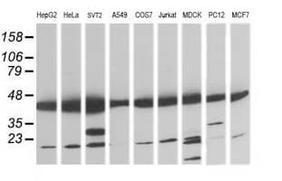 MAP2K1 / MKK1 / MEK1 Antibody (clone OTI7E2)
