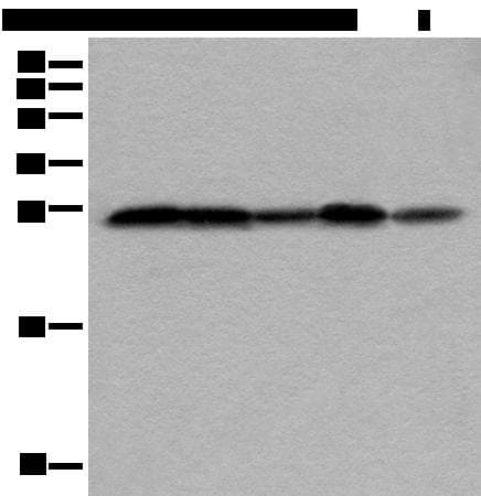 Polyclonal Rabbit anti-Human VTI1A Antibody (IHC, WB)