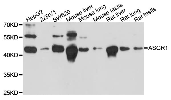 IHC-plus™ ASGR1 / ASGPR Antibody