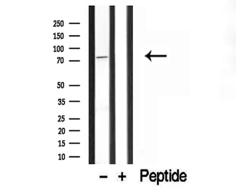 BBS2 / BBS Antibody