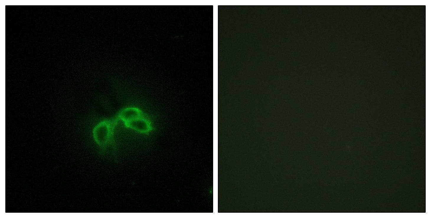 Polyclonal Rabbit anti-Human BLCAP Antibody (IF)