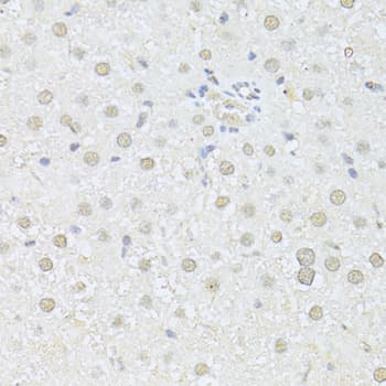 Polyclonal Rabbit anti-Human AKT1 Antibody (IHC, IF, WB)
