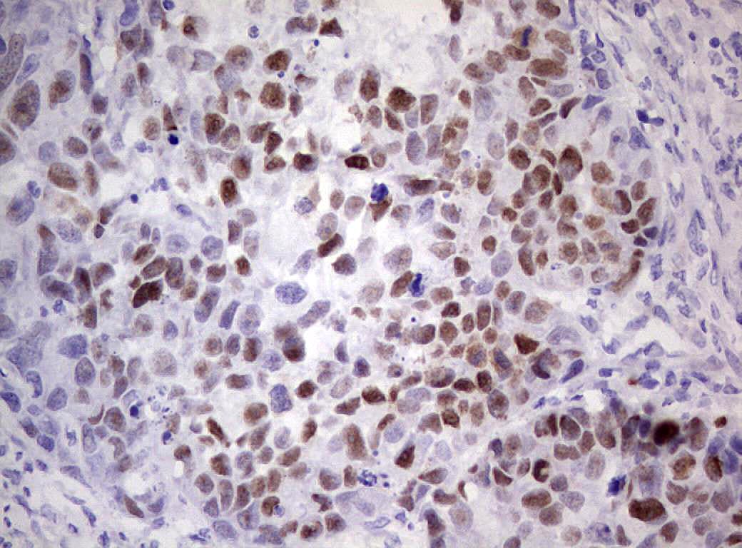 TP53 / p53 Antibody (clone OTI7A2)
