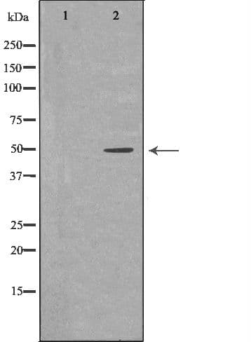 Polyclonal Rabbit anti-Human KIR3DL1 Antibody (IHC, IF, WB)