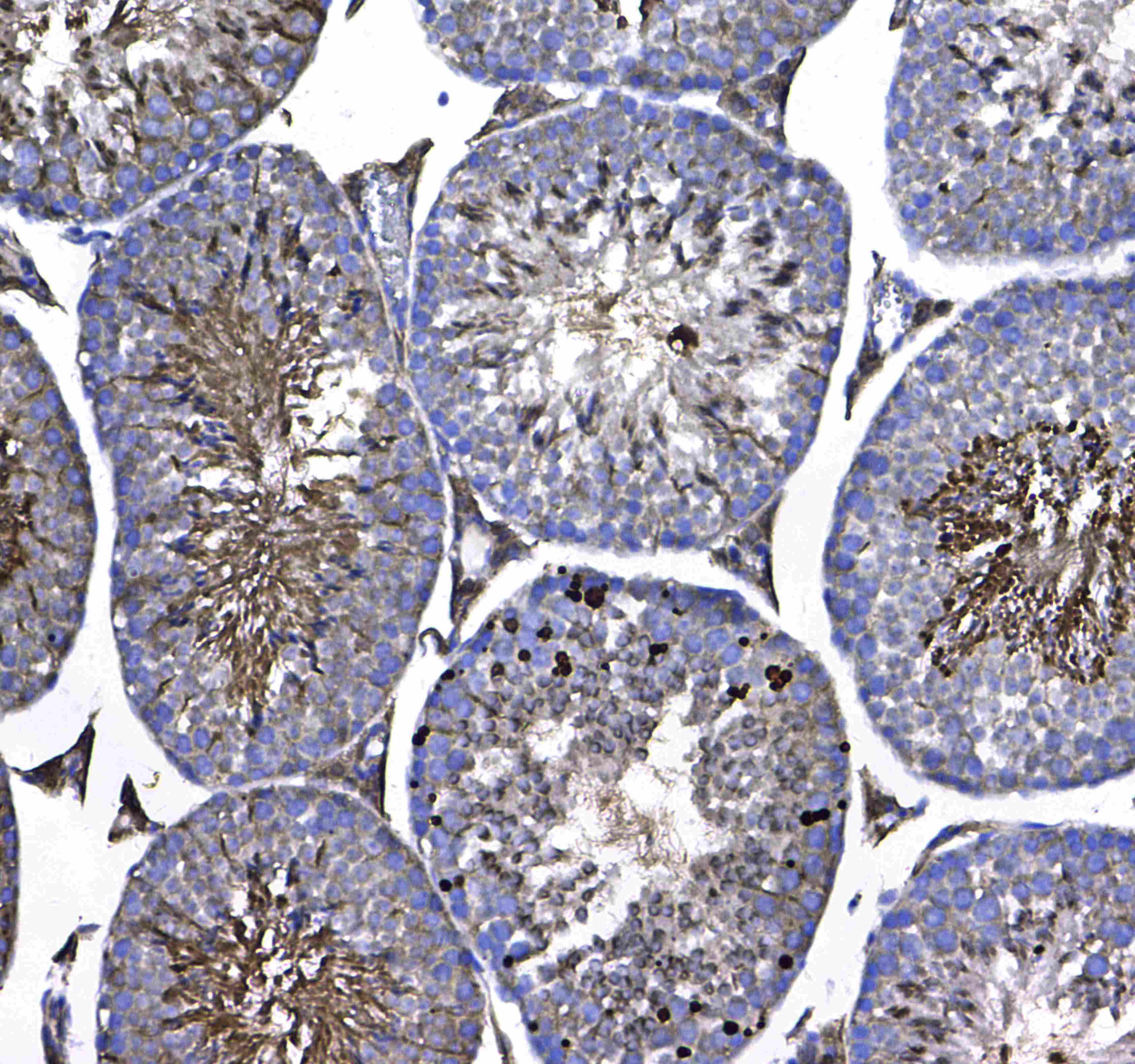 GSTM3 Antibody