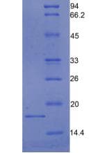 Rat CST3 / Cystatin C Protein (Recombinant His)