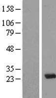 MXD3 / MAD3 Protein (Over-Expression Lysate Myc-DDK (Flag))