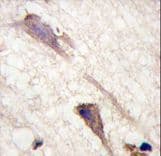 Polyclonal Rabbit anti-Human BRAF / B-Raf Antibody (Ser601, IHC, WB)