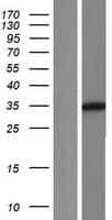 Human GLYAT Protein (Over-Expression Lysate Myc-DDK (Flag))