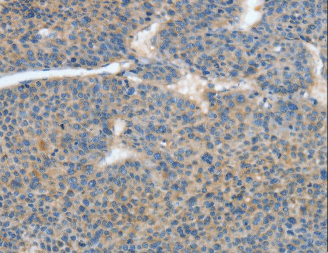 ATP4B Antibody