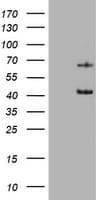 KRT5 / CK5 / Cytokeratin 5 Antibody (aa1-273, clone OTI1E7)