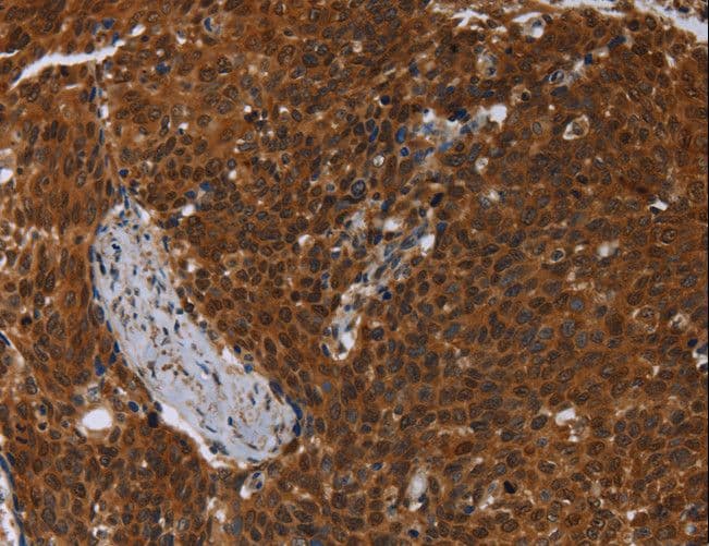Polyclonal Rabbit anti-Human MCHR1 Antibody (IHC, WB)