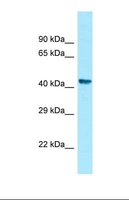 ZNHIT2 Antibody (aa303-352)