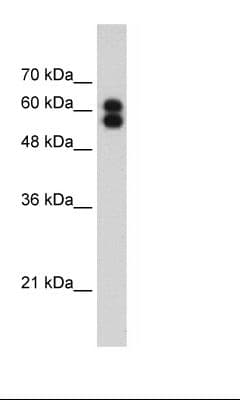 Polyclonal Rabbit anti-Human PLAP / Alkaline Phosphatase Antibody (Biotin, aa411-460, IHC, WB)