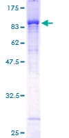 Human YARS / Tyrosyl-tRNA Synthetase Protein (Recombinant GST)