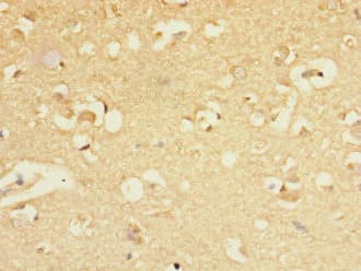 Polyclonal Rabbit anti-Human GABRA5 Antibody (IHC)