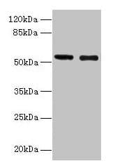 GLP1R / GLP-1 Receptor Antibody (aa24-145)