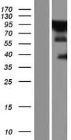 ZC3H14 Protein (Over-Expression Lysate Myc-DDK (Flag))