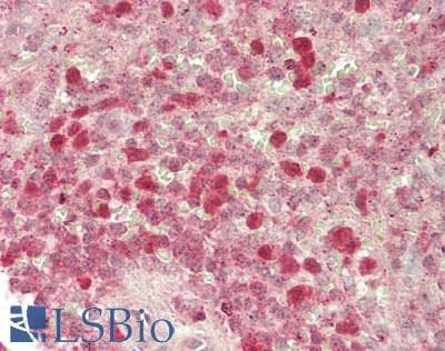 IHC-plus™ MAP4K1 / HPK1 Antibody (aa1-50)