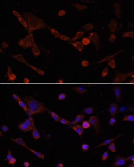 CD4 Antibody
