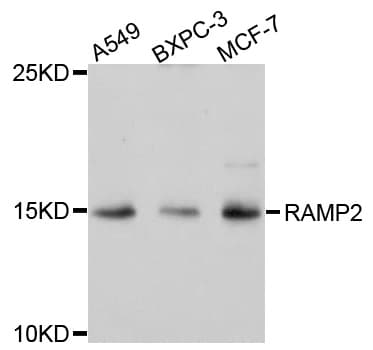 IHC-plus™ RAMP2 Antibody
