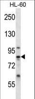 CAPN6 / Calpain 6 Antibody (aa390-419)