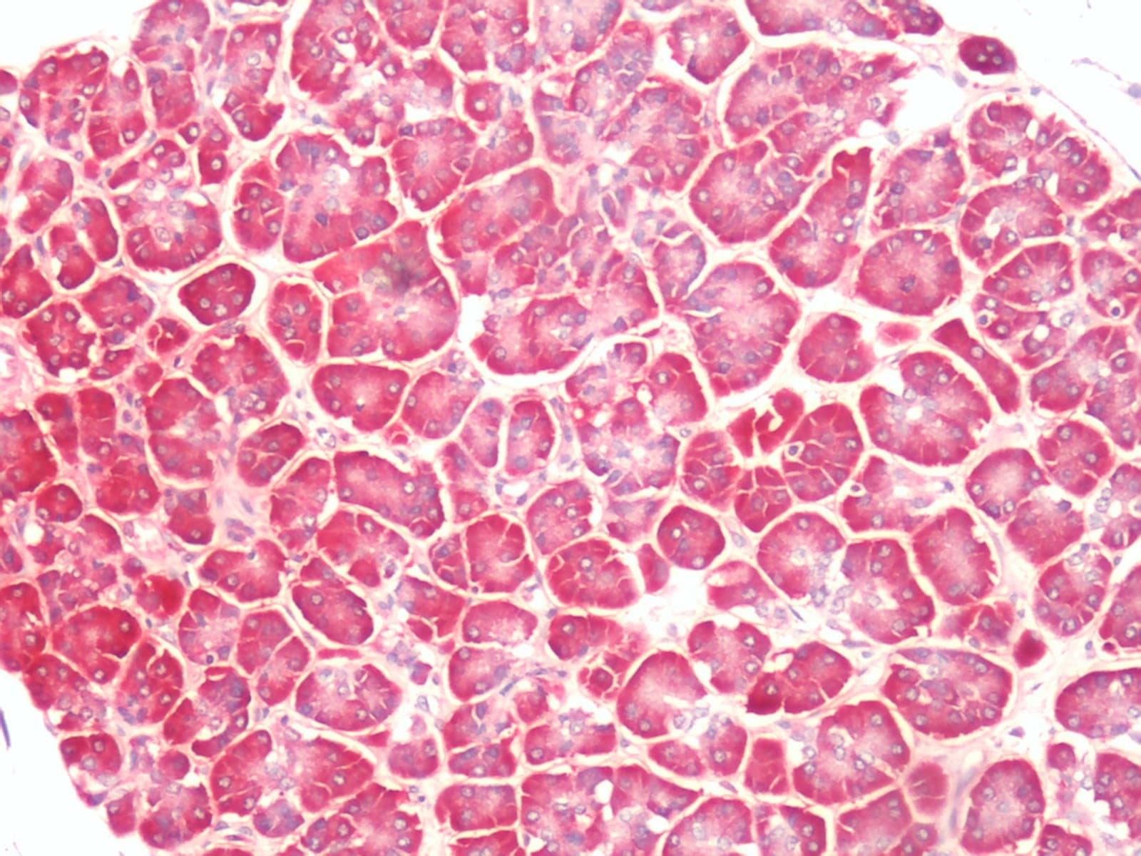 IHC-plus™ Polyclonal Rabbit anti-Human PTGER4 / EP4 Antibody (C-Terminus, IHC)