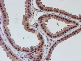 VCAM1 / CD106 Antibody (clone OTI4E8)