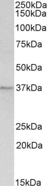 IHC-plus™ ANXA1 / Annexin A1 Antibody (aa324-337)