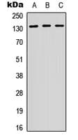 ITGB1 / Integrin Beta 1 / CD29 Antibody (C-Terminus)