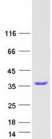 Human TOLLIP Protein (Recombinant Myc-DDK (Flag))