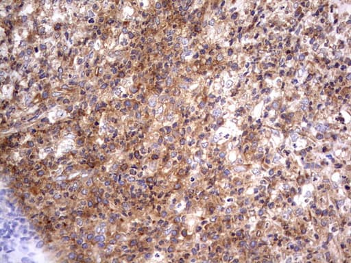 Polyclonal Rabbit anti-Human RELA / NFKB p65 Antibody (aa100-170, IHC, WB)