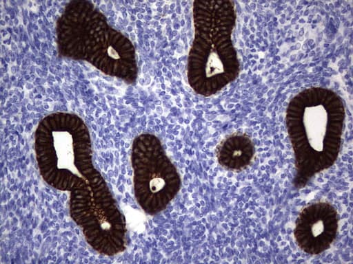 IHC-plus™ Acidic Cytokeratin Antibody (clone 1D10)