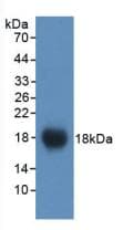 VCAM1 / CD106 Antibody (aa511-682)