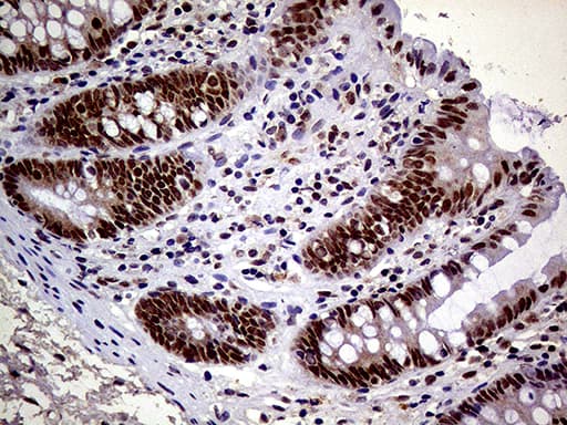 Monoclonal Mouse anti-Human MAGEB4 Antibody (clone OTI3A3, Carrier-free, aa1-193, IHC, WB)