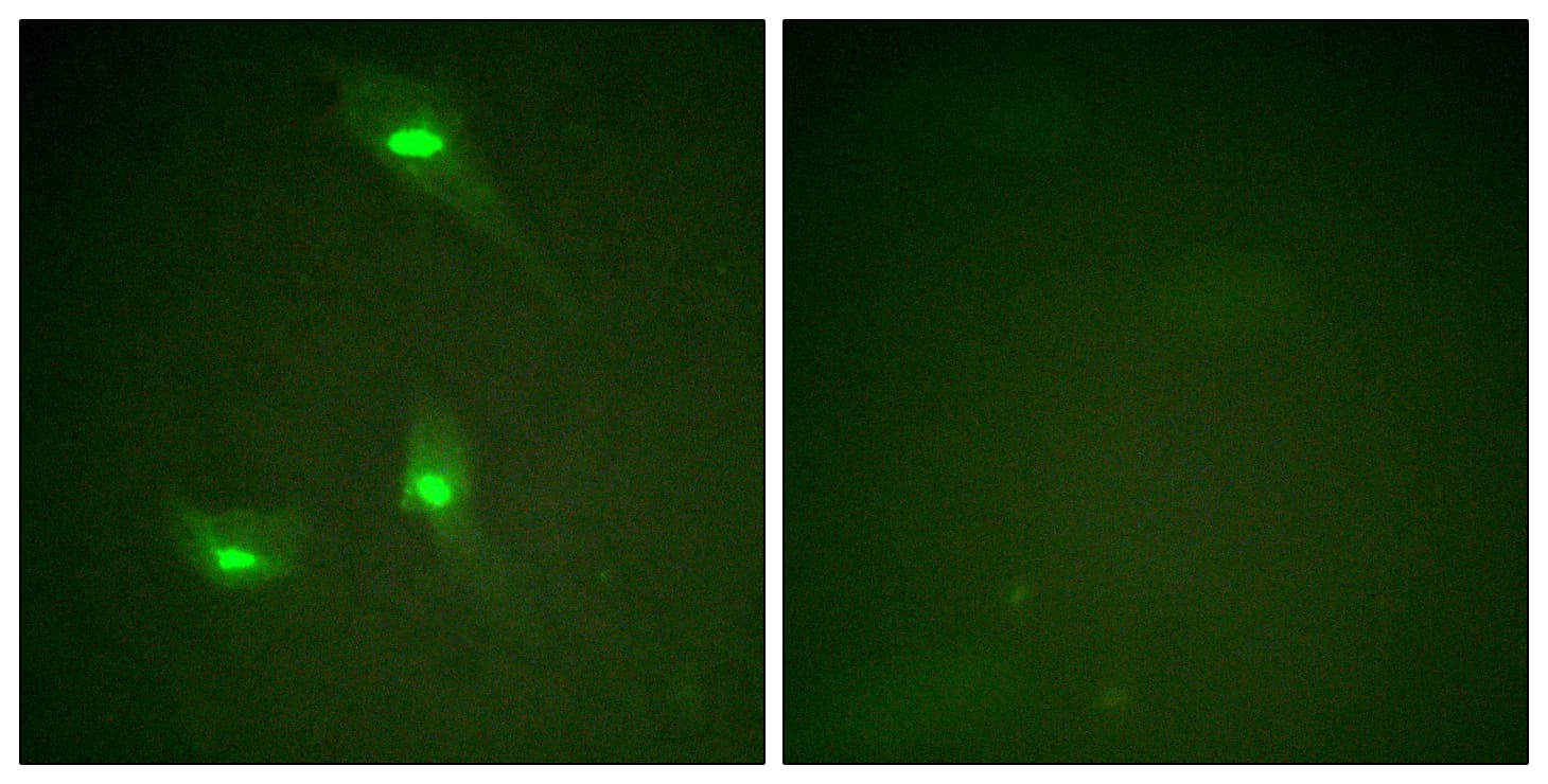 Polyclonal Rabbit anti-Human RACGAP1 / MGCRACGAP Antibody (phospho-Ser387, IHC, IF, WB)