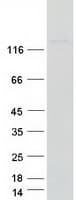 Human NUP155 Protein (Recombinant Myc-DDK (Flag))