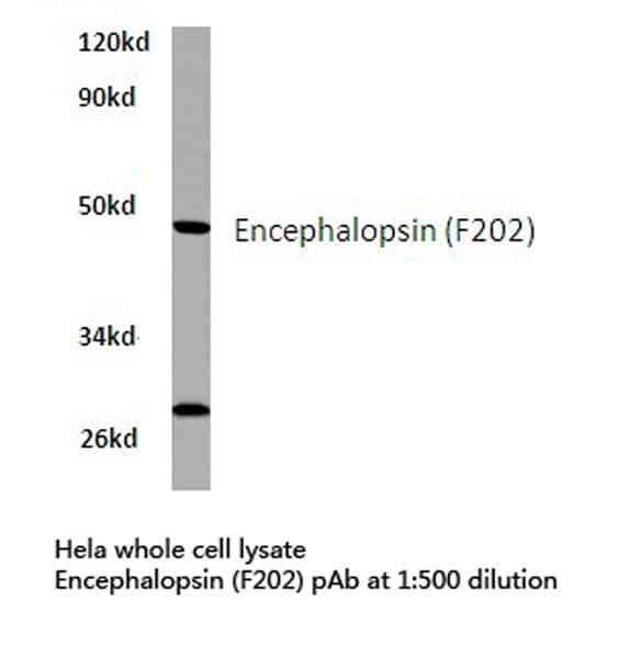 Polyclonal Rabbit anti-Human Encephalopsin / OPN3 Antibody (Phe202, IHC, IF, WB)