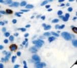 TPSAB1 / Mast Cell Tryptase Antibody (clone G3, Ready-to-Use)